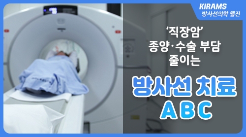 ＇직장암＇ 종양·수술 부담 줄이는 방사선 치료 ABC 